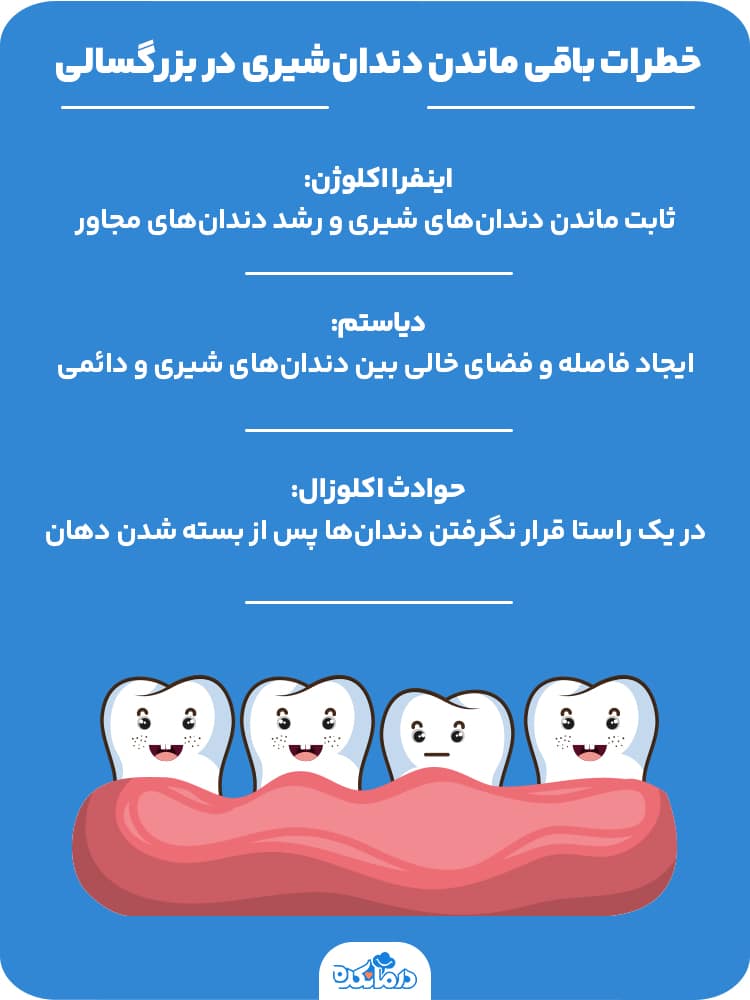 اینفوگرافیک خطرات باقی ماندن دندان‌شیری در بزرگسالی