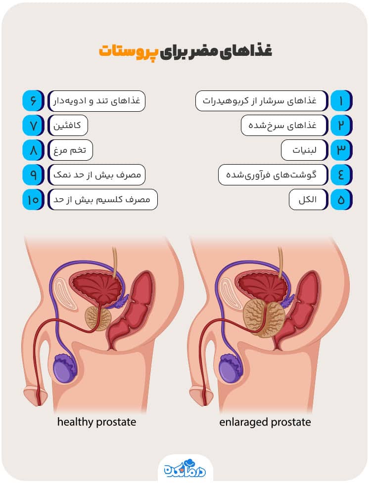 برای ورم پروستات چی بخوریم؟