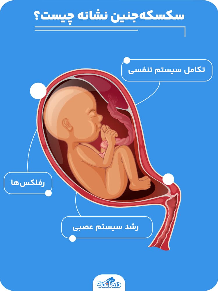 اینفوگرافیک سکسکه‌جنین نشانه چیست؟