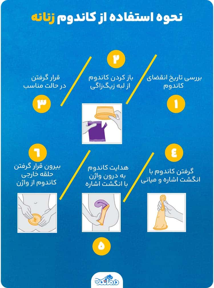 اینفوگرافیک نحوه استفاده از کاندوم زنانه