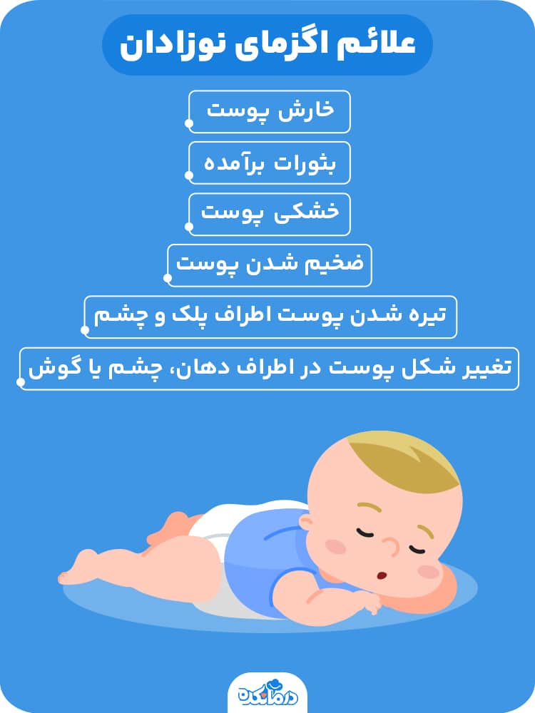 اینفوگرافیک علائم اگزمای نوزادان