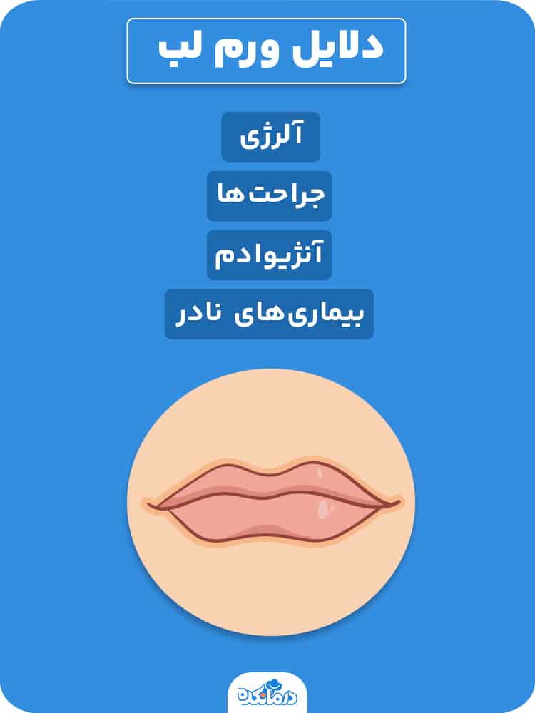 اینفوگرافی درباره دلایل ورم لب