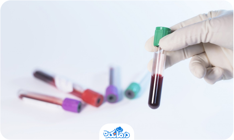 تعدادی لوله آزمایش حاوی خون