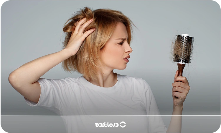 تصویر یک زن جوان که دچار ریزش مو شده است