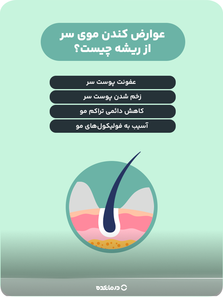اینفوگرافیکی درباره عوارض کندن موی سر از ریشه.