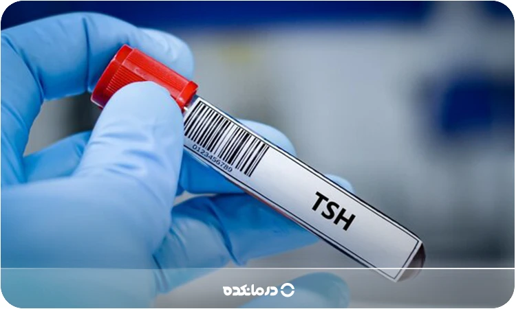 تصویر لوله آزمایشگاهی با برچسب TSH