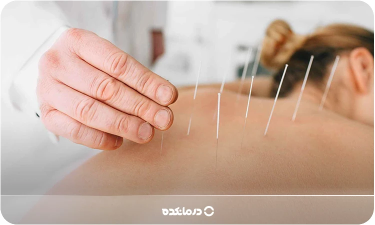 تصویر فرو کردن سوزنهای طب سوزنی در پشت بدن