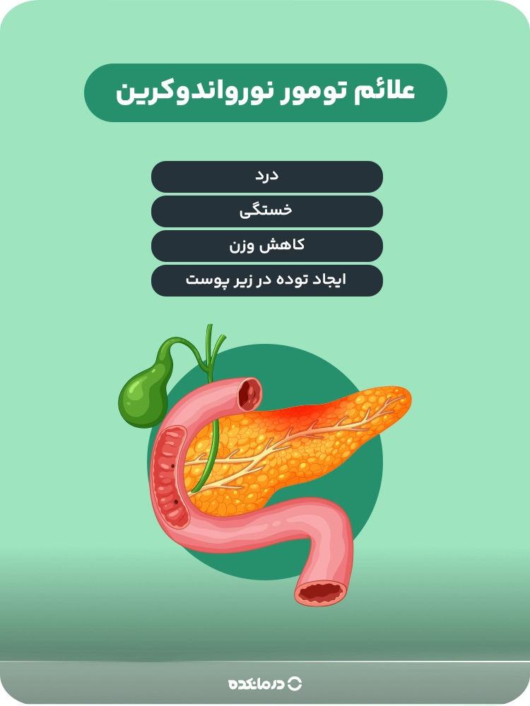 اینفوگرافی «علائم تومور نورواندوکرین» (درد/ خستگی/ کاهش وزن/ ایجاد توده در زیر پوست)