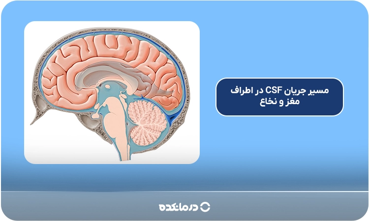 نمای شماتیک از موقعیت و مسیر جریان CSF در اطراف مغز و نخاع