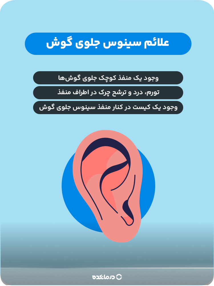 اینفوگرافیک علائم سینوس جلوی گوش