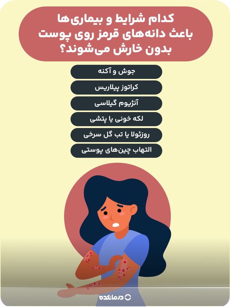 اینفوگرافیک کدام شرایط و بیماریها باعث دانههای قرمز روی پوست بدون خارش میشوند؟