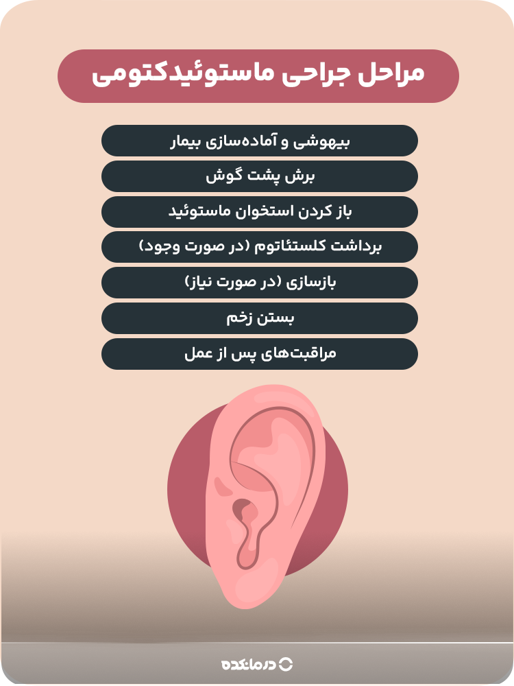 اینفوگرافی مراحل جراحی ماستوئیدکتومی
