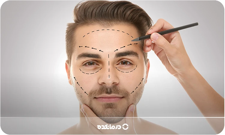 تصویر یک زن که پزشک نقاط جراحی را روی صورت او مشخص کرده است