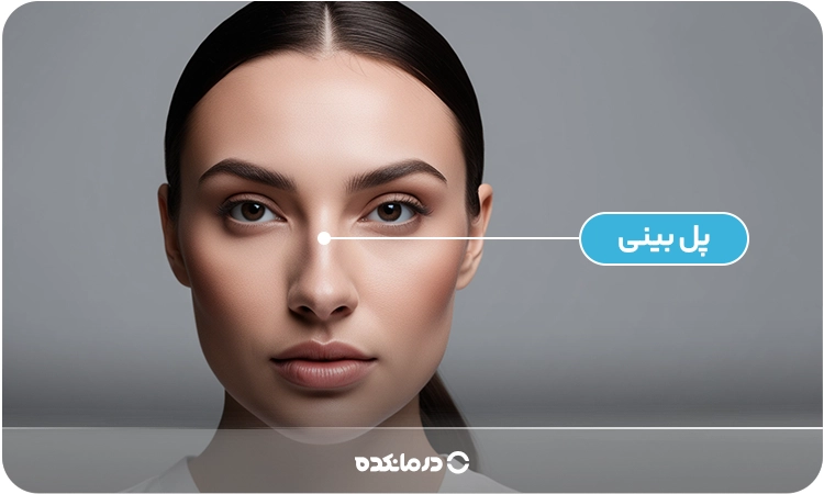تصویری که محل پل بینی را بین دو ابرو نشان میدهد را می بینید