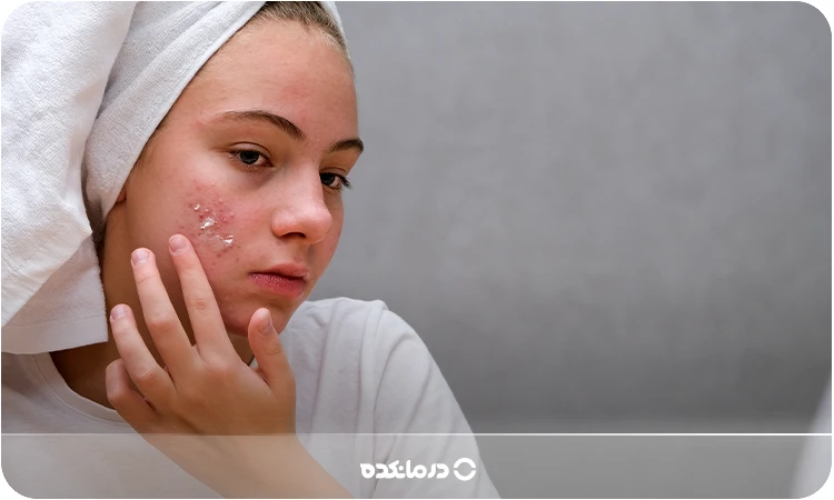 آلترنیتیو: تصویر پماد روی صورت یک خانم (ترجیحا دارای لک) را می‌بینید