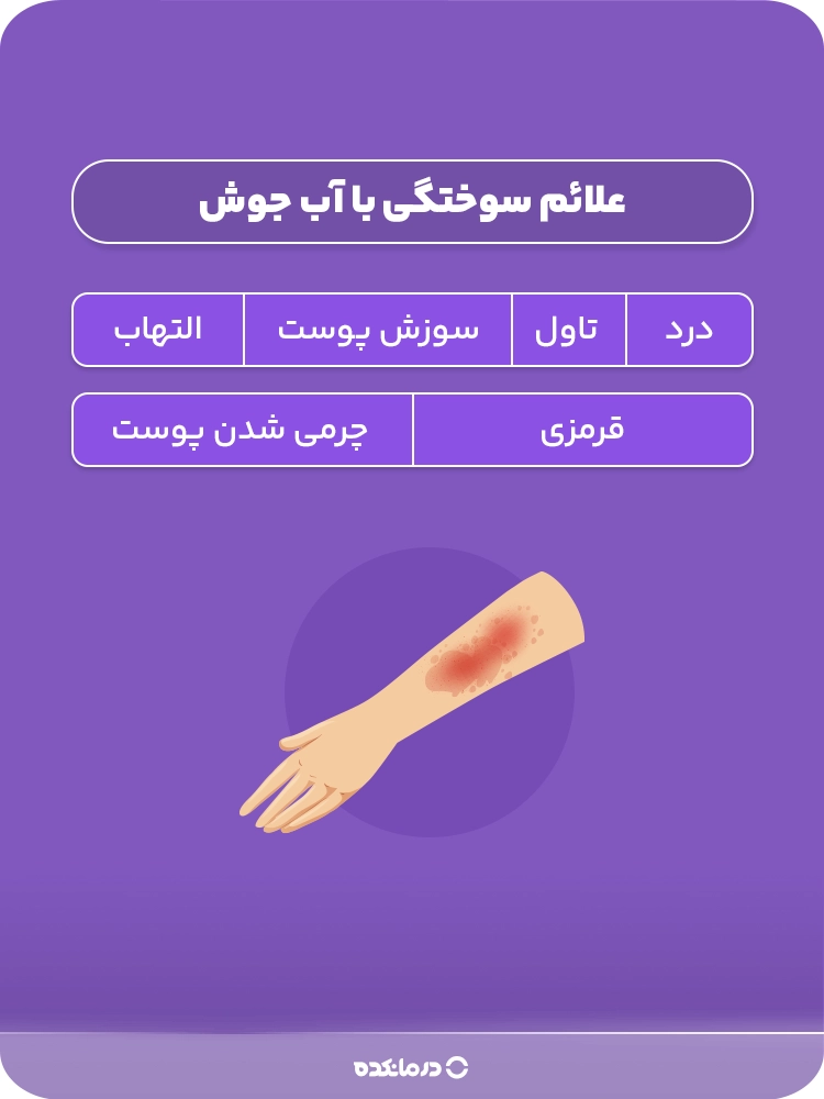 اینفوگرافی «علائم سوختگی با آب جوش»