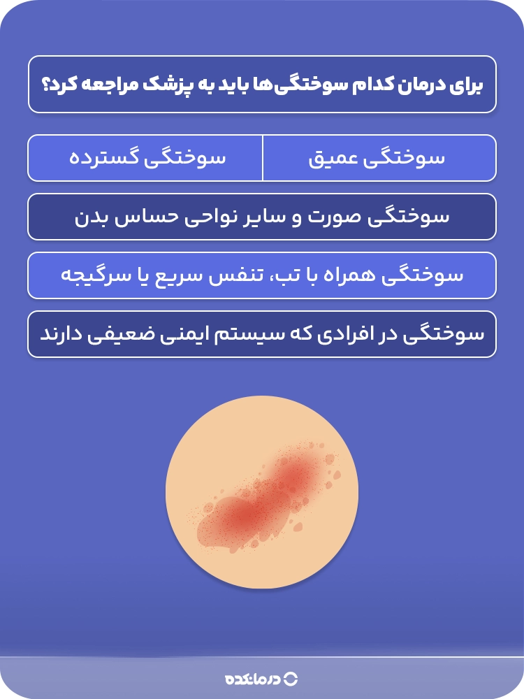 اینفوگرافی «برای درمان کدام سوختگیها باید به پزشک مراجعه کرد؟
