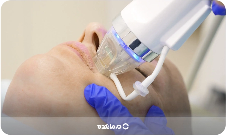 تصویر فردی که در مطب پزشک Fractional RF انجام می‌دهد