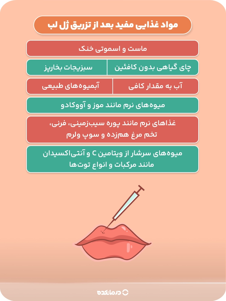 اینفوگرافیک مواد غذایی مفید بعد از تزریق ژل لب
