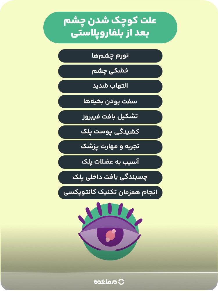 اینفوگرافیک علت کوچک شدن چشم بعد از بلفاروپلاستی