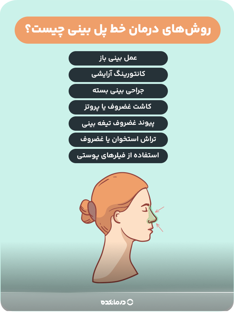 اینفوگرافیک درباره روشهای درمان خط پل بینی
