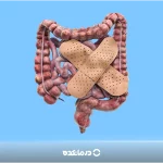 کولیت روده چیست و چه علائمی دارد؟ [۳ علت + درمان قطعی]