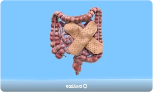 کولیت روده چیست و چه علائمی دارد؟ [۳ علت + درمان قطعی]