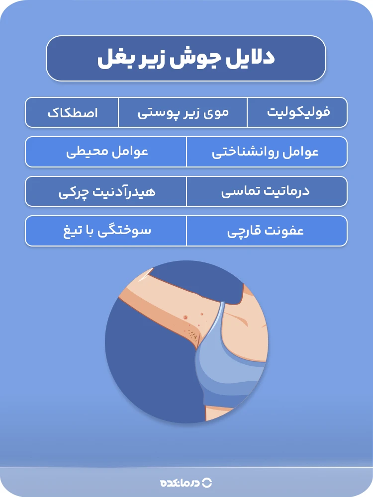 اینفوگرافی «دلایل جوش زیر بغل» (۷ مورد)