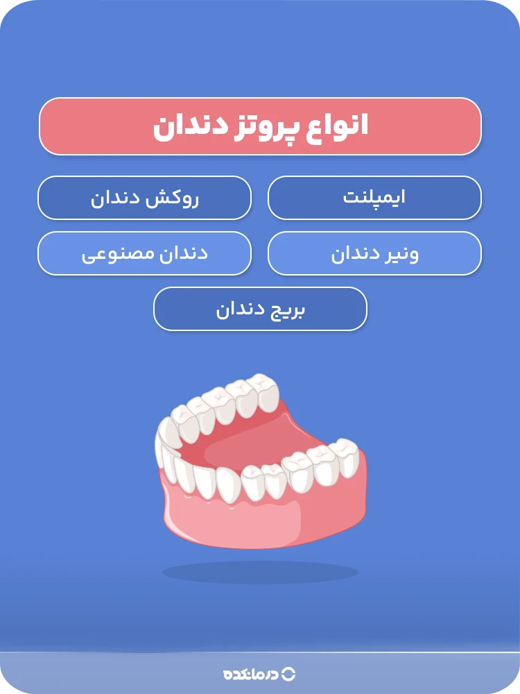 اینفوگرافی «انواع پروتز دندان» 