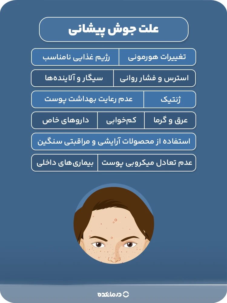 اینفوگرافی علت جوش پیشانی