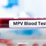 MPV در آزمایش خون؛ مقدار نرمال + درمان پایین و بالا بودن