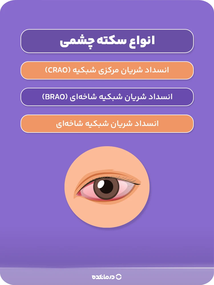 اینفوگرافیک انواع سکته چشمی