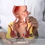 دشمن بواسیر [چه بخوریم تا بواسیر از بین برود؟]