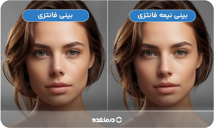 تصویر یک خانم زیبا با بینی جراحی شده به صورت فانتزی و نیمه فانتزی