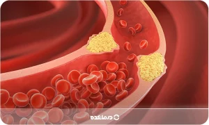 برای کاهش سریع چربی خون چه بخوریم؟ [۱۹ خوراکی شفابخش]