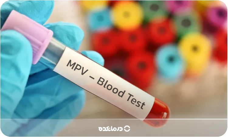 تصویر لوله آزمایشگاه با برچسب تست MPV را می بینید