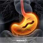 عفونت معده [دلیل و علائم] ۴ روش درمان + درمان خانگی