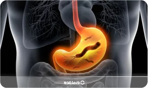 عفونت معده [دلیل و علائم] ۴ روش درمان + درمان خانگی