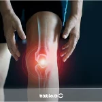 قرص مسکن قوی برای استخوان درد [۱۰ دارو] روش مصرف و عوارض