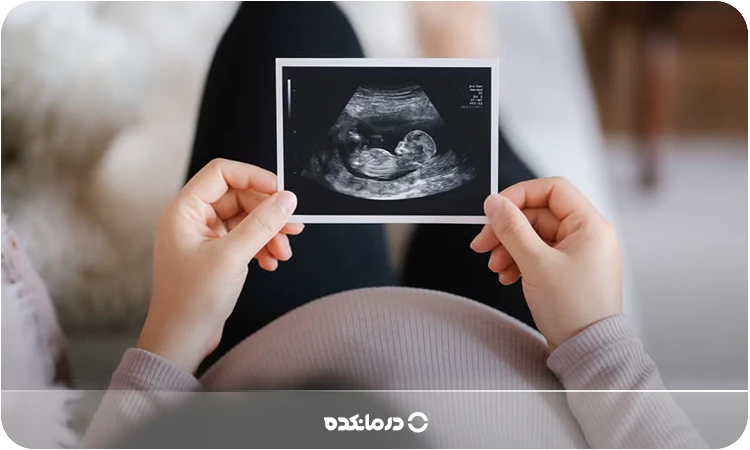 یک زن باردار که تصویر سونوگرافی خود را در دست دارد را می بینید