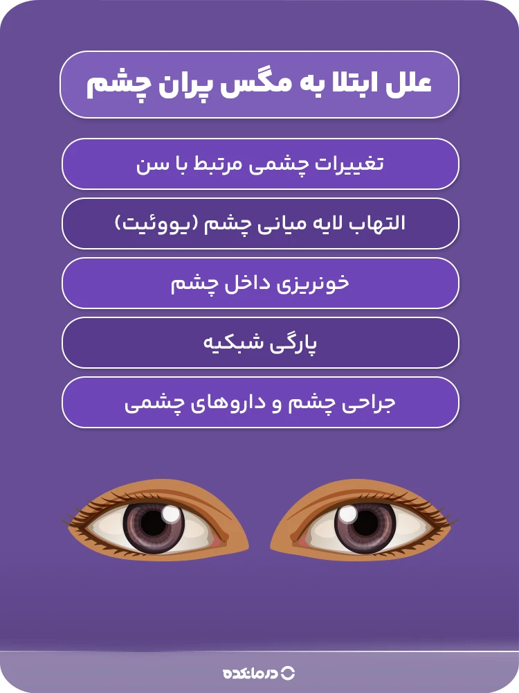 علت ابتلا به مگس پران چشم