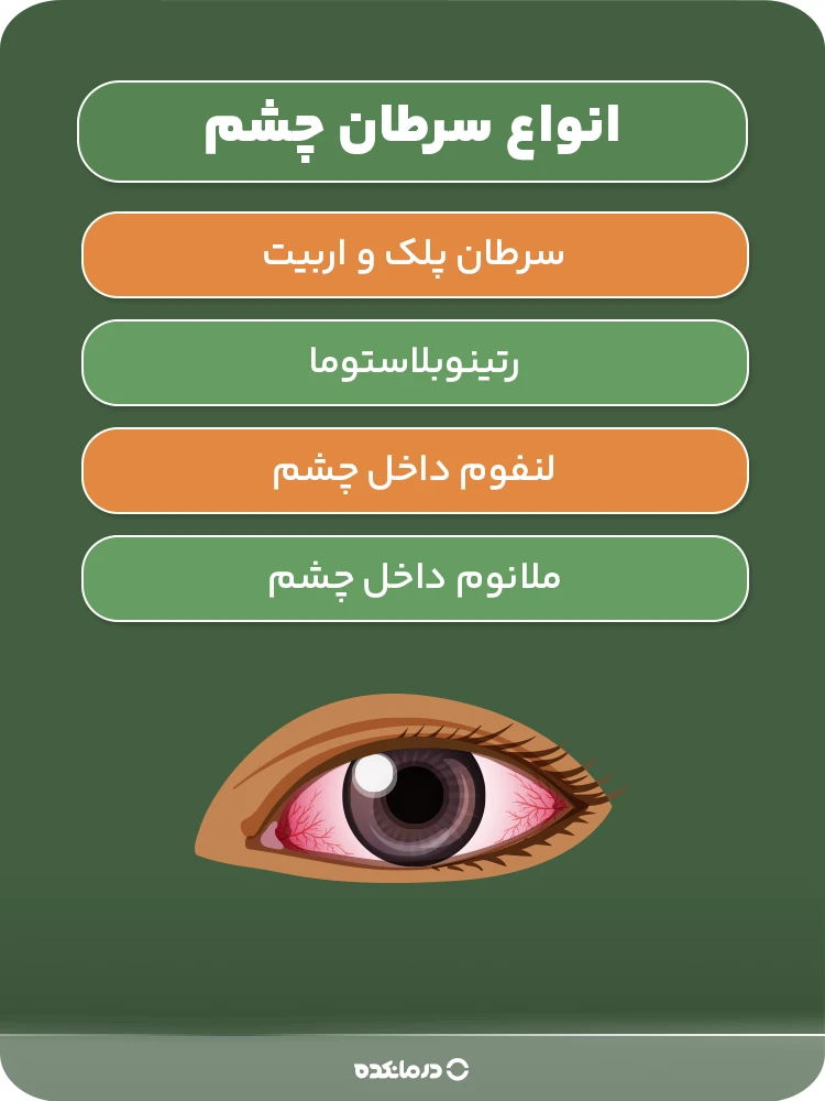 اینفوگرافی «انواع سرطان چشم»