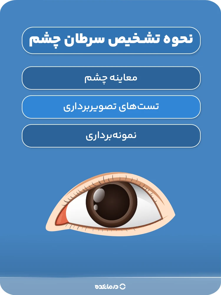 اینفوگرافی «نحوه تشخیص سرطان چشم»