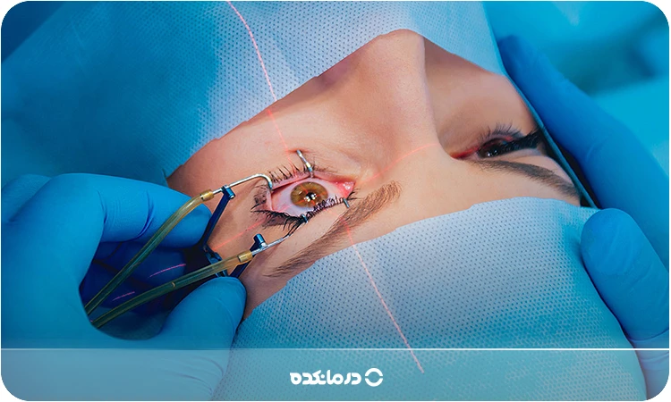 تصویر پزشک در حال جراحی چشم را می بینید