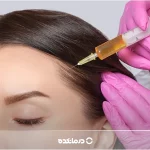 فیلر مو چیست؟ [۹ فایده، نحوه تزریق + ماندگاری هیر فیلر]