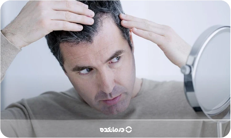 تصویر فردی که دچار ریزش مو شده است را می بینید