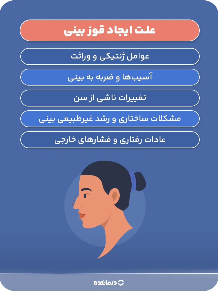اینفوگرافی علت ایجاد قوز بینی