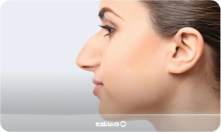 تصویر فردی با بینی قوز دار را می بینید