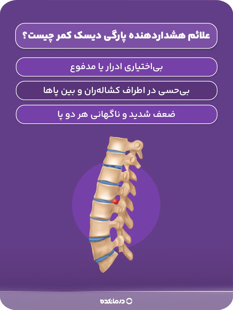اینفوگرافیک علائم هشدار‌دهنده پارگی دیسک کمر