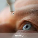 بهترین قطره برای کاهش فشار چشم [۱۴ داروی قوی + روش مصرف]